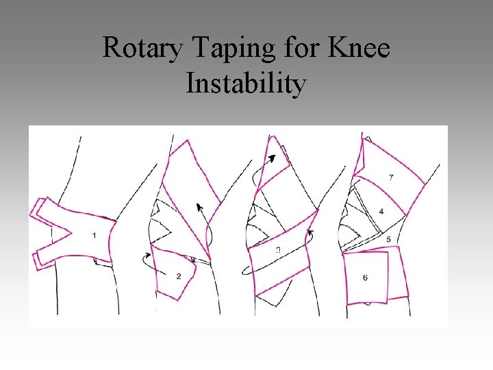 Rotary Taping for Knee Instability 