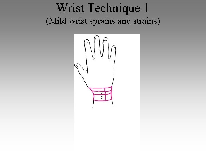 Wrist Technique 1 (Mild wrist sprains and strains) 