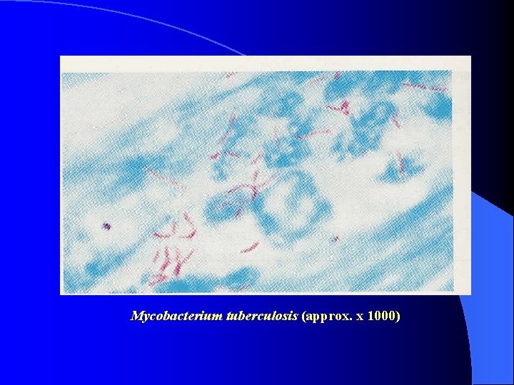 Mycobacterium tuberculosis (approx. x 1000) 