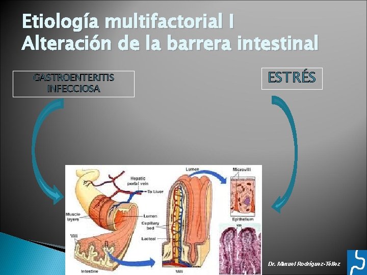 Etiología multifactorial I Alteración de la barrera intestinal GASTROENTERITIS INFECCIOSA ESTRÉS Dr. Manuel Rodríguez-Téllez