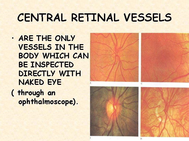 CENTRAL RETINAL VESSELS • ARE THE ONLY VESSELS IN THE BODY WHICH CAN BE
