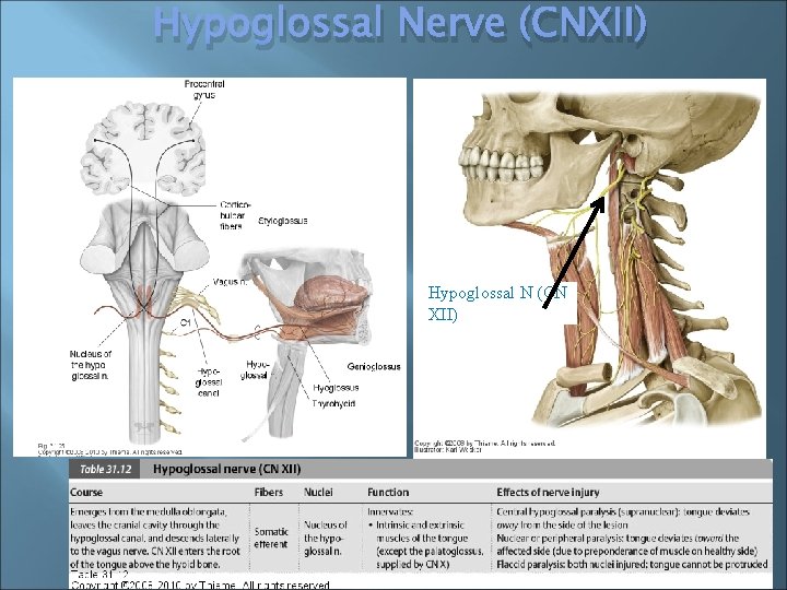 Hypoglossal Nerve (CNXII) Hypoglossal N (CN XII) 