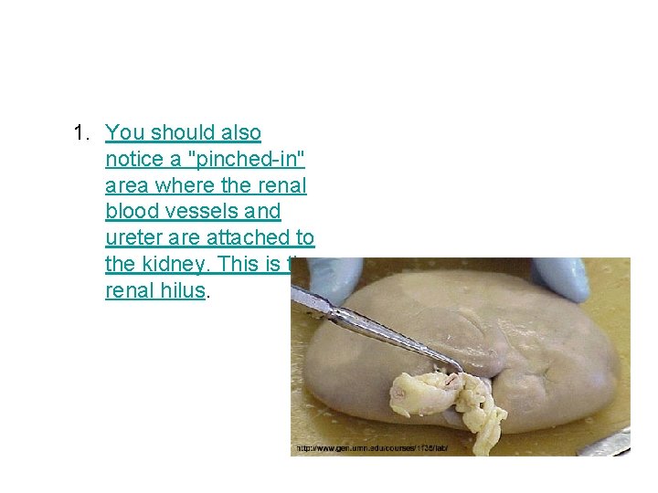 1. You should also notice a "pinched-in" area where the renal blood vessels and