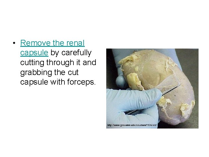  • Remove the renal capsule by carefully cutting through it and grabbing the