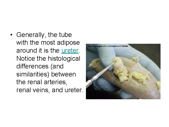  • Generally, the tube with the most adipose around it is the ureter.