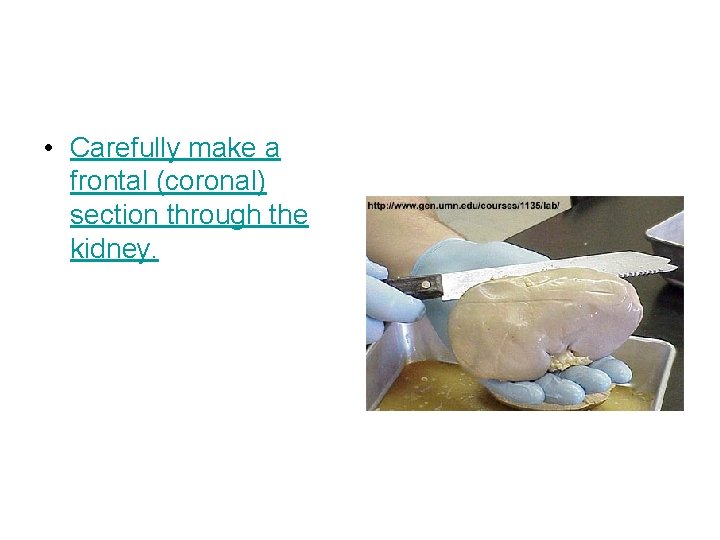  • Carefully make a frontal (coronal) section through the kidney. 