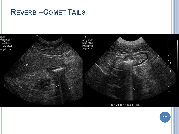 REVERB – COMET TAILS 12 