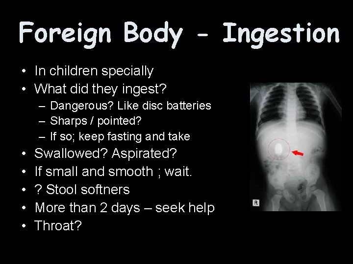 Foreign Body - Ingestion • In children specially • What did they ingest? –
