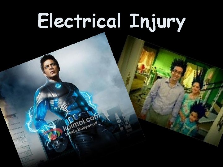 Electrical Injury 