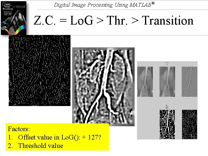 Digital Image Processing Using MATLAB® Z. C. = Lo. G > Thr. > Transition