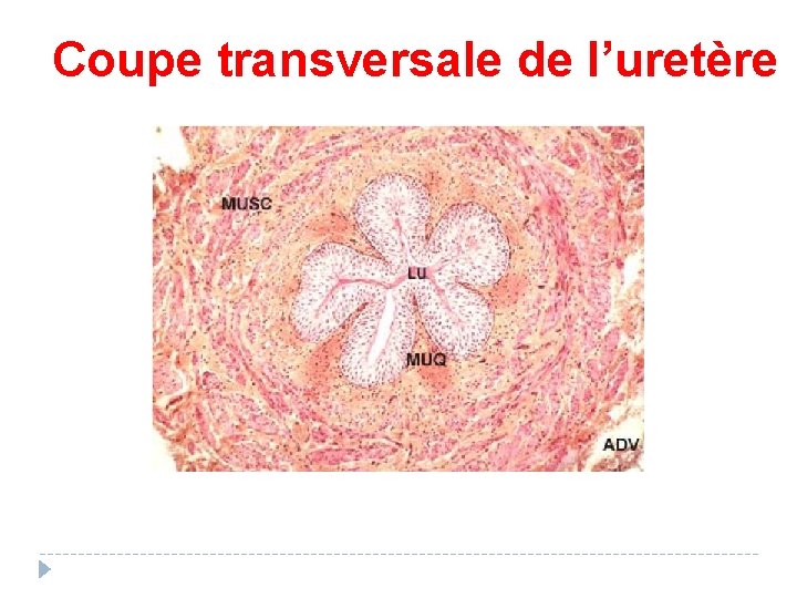 Coupe transversale de l’uretère 