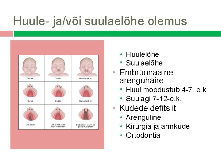 Huule- ja/või suulaelõhe olemus Embrüonaalne arenguhäire: Huulelõhe Suulaelõhe Huul moodustub 4 -7. e. k