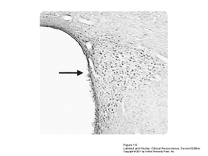 Figure 1. 6 Lambert and Kinsley: Clinical Neuroscience, Second Edition Copyright © 2011 by