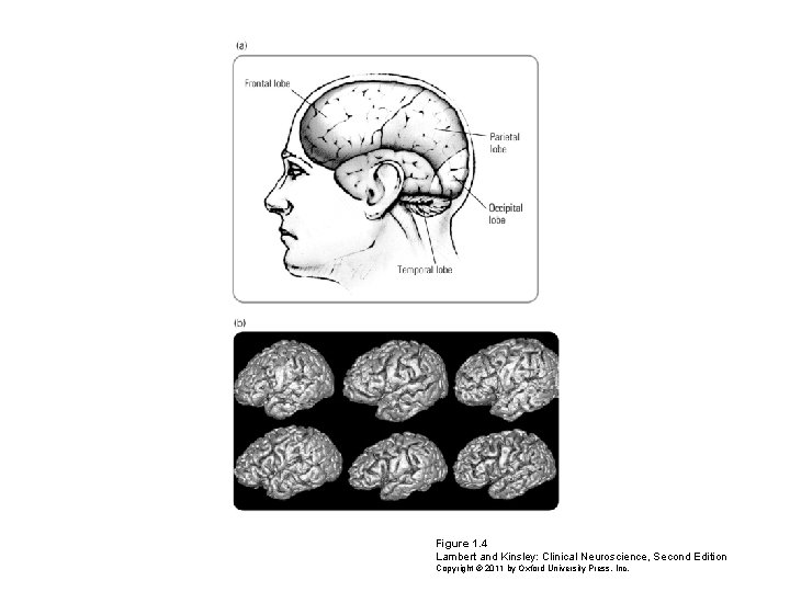 Figure 1. 4 Lambert and Kinsley: Clinical Neuroscience, Second Edition Copyright © 2011 by