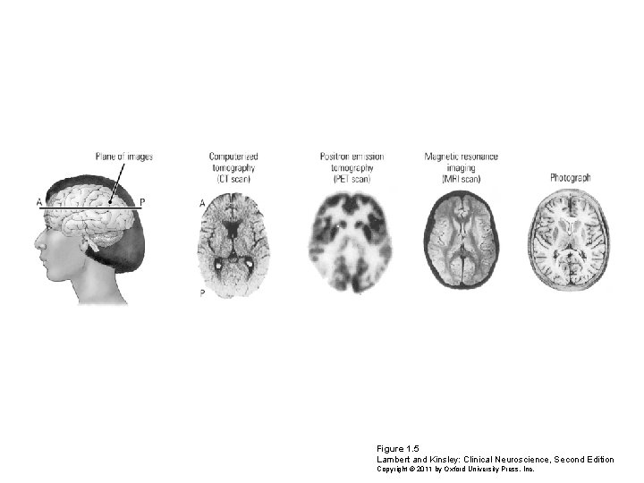 Figure 1. 5 Lambert and Kinsley: Clinical Neuroscience, Second Edition Copyright © 2011 by