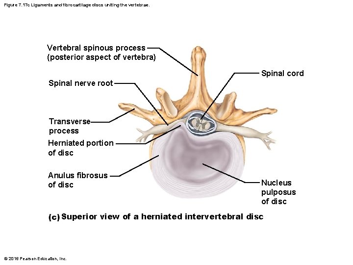 Figure 7. 17 c Ligaments and fibrocartilage discs uniting the vertebrae. Vertebral spinous process