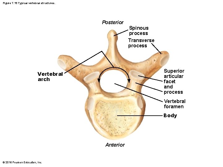 Figure 7. 19 Typical vertebral structures. Posterior Spinous process Transverse process Superior articular facet