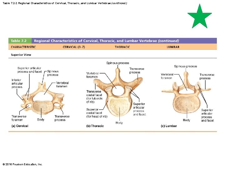 Table 7. 2 -2 Regional Characteristics of Cervical, Thoracic, and Lumbar Vertebrae (continued) ©