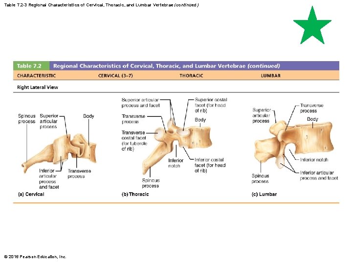 Table 7. 2 -3 Regional Characteristics of Cervical, Thoracic, and Lumbar Vertebrae (continued) ©