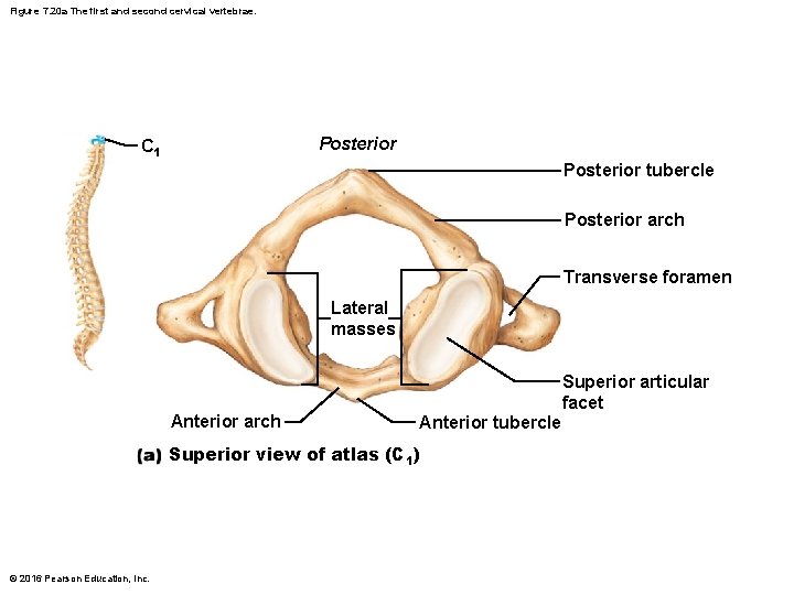 Figure 7. 20 a The first and second cervical vertebrae. Posterior C 1 Posterior