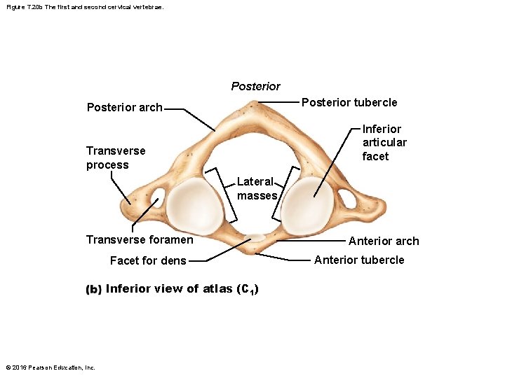 Figure 7. 20 b The first and second cervical vertebrae. Posterior tubercle Posterior arch