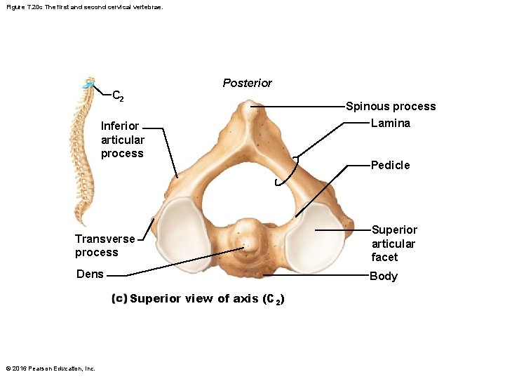 Figure 7. 20 c The first and second cervical vertebrae. Posterior C 2 Spinous