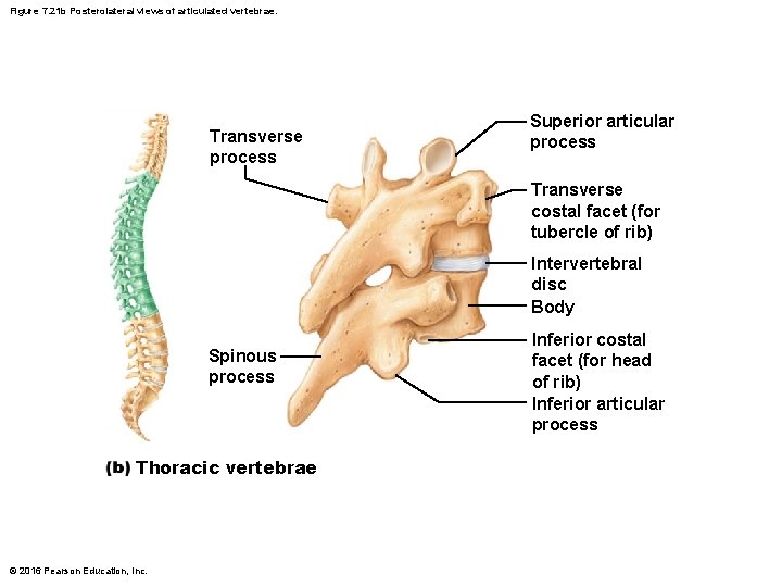 Figure 7. 21 b Posterolateral views of articulated vertebrae. Transverse process Superior articular process