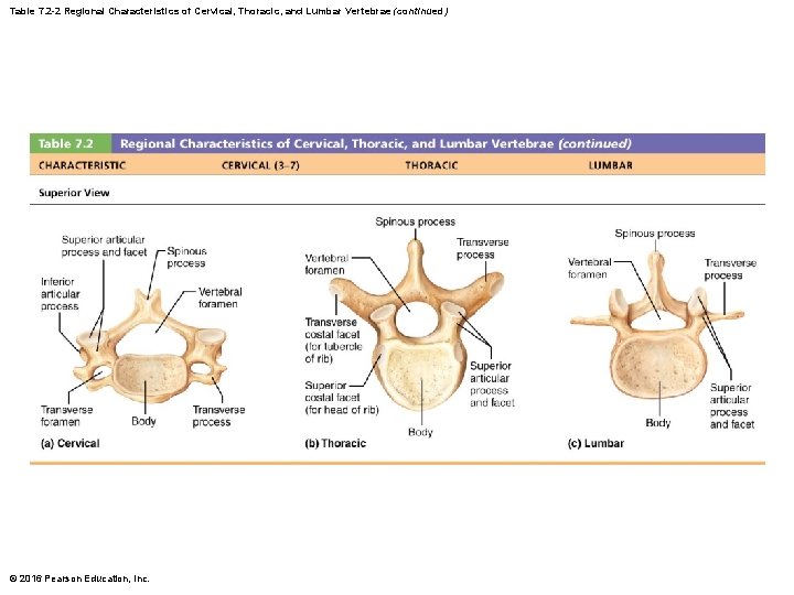 Table 7. 2 -2 Regional Characteristics of Cervical, Thoracic, and Lumbar Vertebrae (continued) ©