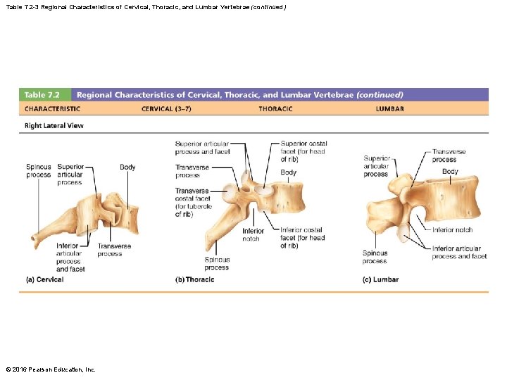 Table 7. 2 -3 Regional Characteristics of Cervical, Thoracic, and Lumbar Vertebrae (continued) ©