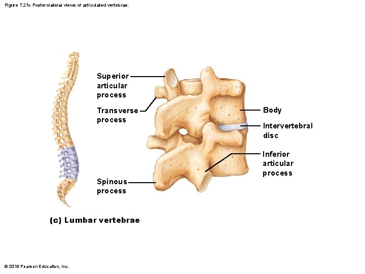 Figure 7. 21 c Posterolateral views of articulated vertebrae. Superior articular process Transverse process