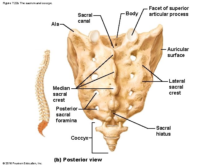 Figure 7. 22 b The sacrum and coccyx. Sacral canal Ala Body Facet of