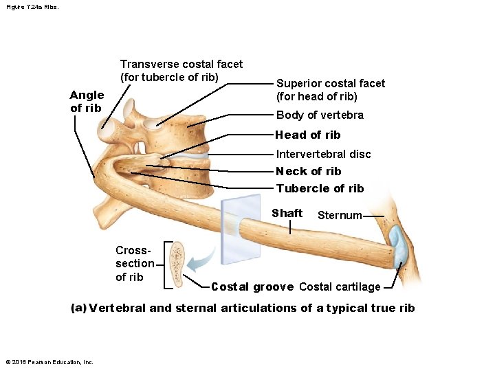 Figure 7. 24 a Ribs. Transverse costal facet (for tubercle of rib) Angle of