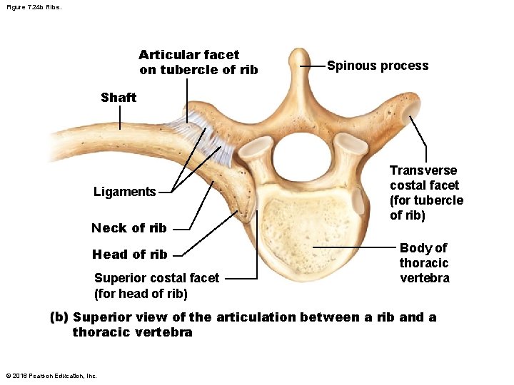 Figure 7. 24 b Ribs. Articular facet on tubercle of rib Spinous process Shaft