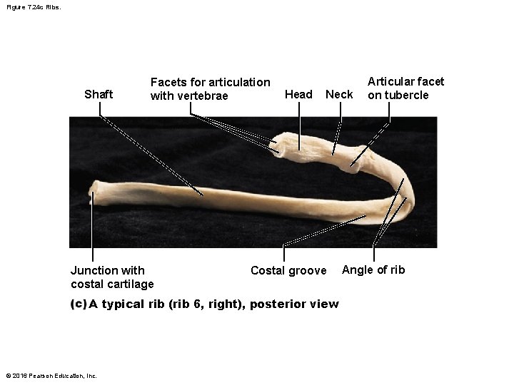 Figure 7. 24 c Ribs. Shaft Facets for articulation with vertebrae Junction with costal