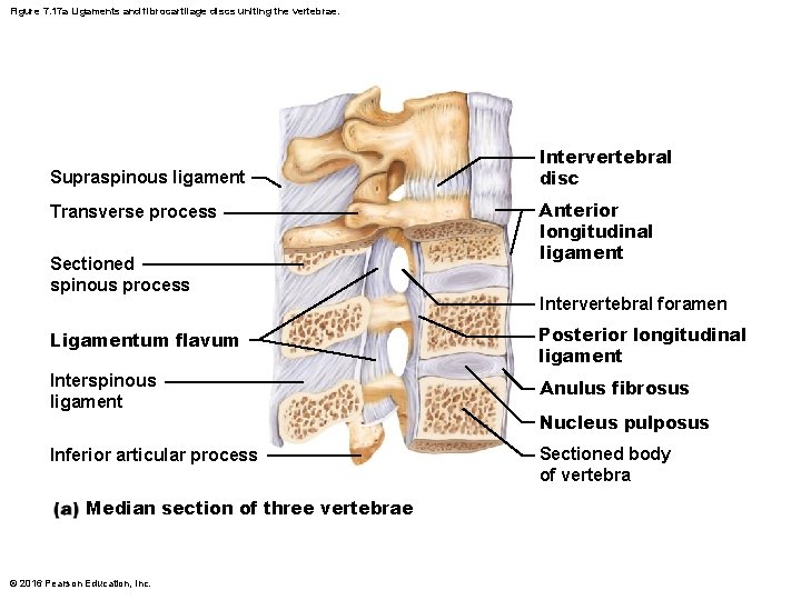 Figure 7. 17 a Ligaments and fibrocartilage discs uniting the vertebrae. Supraspinous ligament Transverse