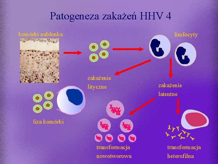 Patogeneza zakażeń HHV 4 komórki nabłonka limfocyty zakażenie lityczne zakażenie latentne liza komórki transformacja
