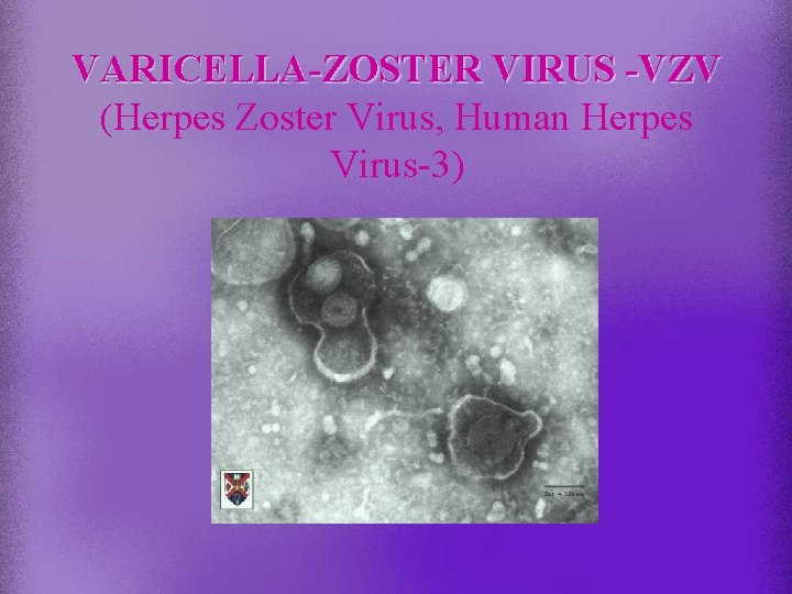 VARICELLA-ZOSTER VIRUS -VZV (Herpes Zoster Virus, Human Herpes Virus-3) 