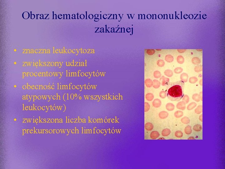 Obraz hematologiczny w mononukleozie zakaźnej • znaczna leukocytoza • zwiększony udział procentowy limfocytów •