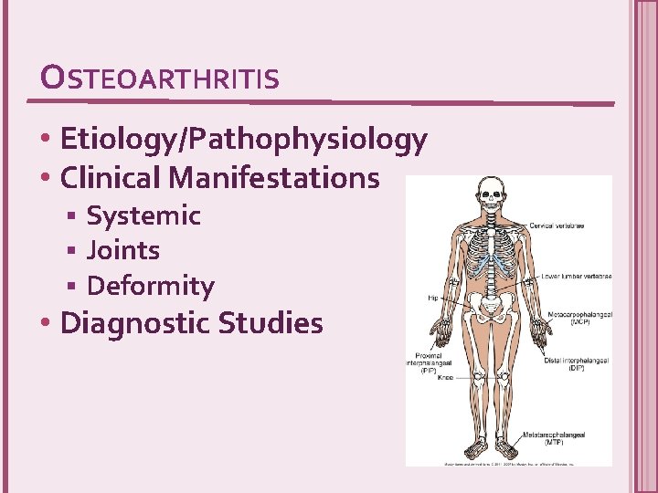 OSTEOARTHRITIS • Etiology/Pathophysiology • Clinical Manifestations § § § Systemic Joints Deformity • Diagnostic