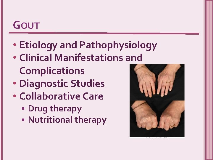 GOUT • Etiology and Pathophysiology • Clinical Manifestations and Complications • Diagnostic Studies •