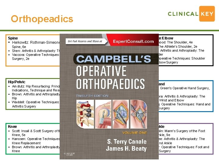 Orthopeadics Spine § Herkowitz: Rothman-Simeone The Spine, 6 e § Shen: Arthritis & Arthroplasty: