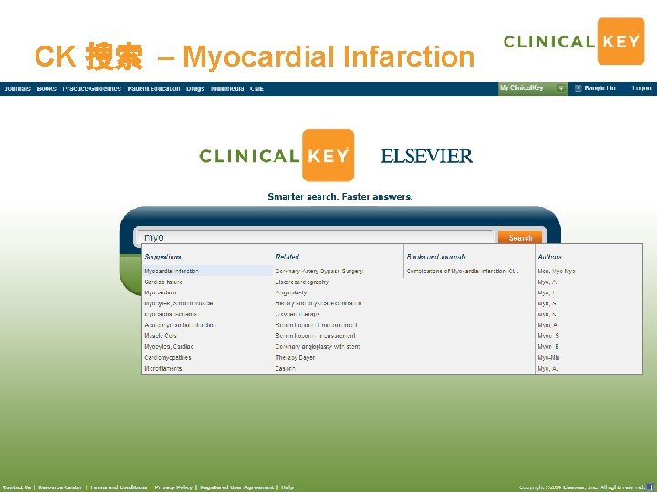 CK 搜索 – Myocardial Infarction Intro of Elsevier Clinical. Key: Demo Summary 