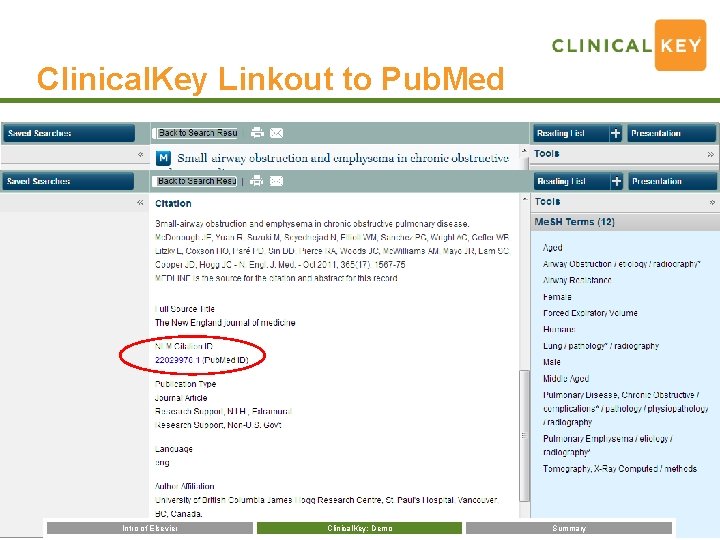 Clinical. Key Linkout to Pub. Med Intro of Elsevier Clinical. Key: Demo Summary 