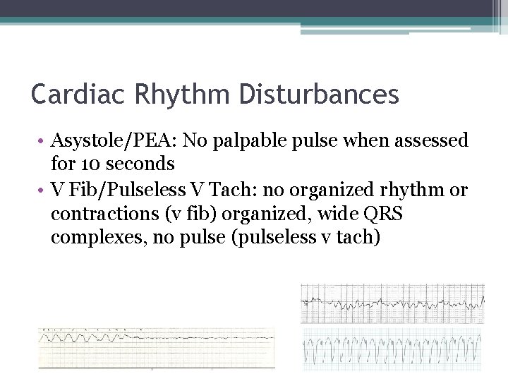Cardiac Rhythm Disturbances • Asystole/PEA: No palpable pulse when assessed for 10 seconds • Cardiac Rhythm Disturbances • Asystole/PEA: No palpable pulse when assessed for 10 seconds •