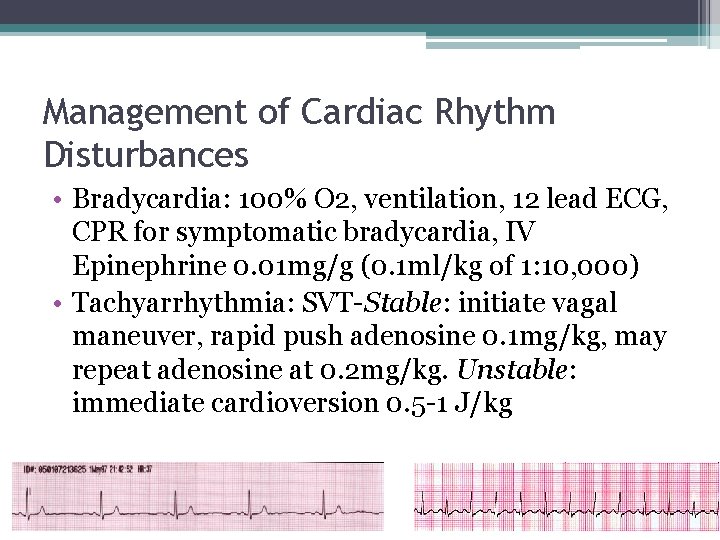 Management of Cardiac Rhythm Disturbances • Bradycardia: 100% O 2, ventilation, 12 lead ECG, Management of Cardiac Rhythm Disturbances • Bradycardia: 100% O 2, ventilation, 12 lead ECG,