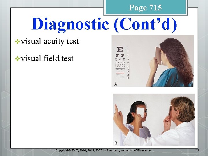 Page 715 Diagnostic (Cont’d) v visual acuity test v visual field test Copyright ©