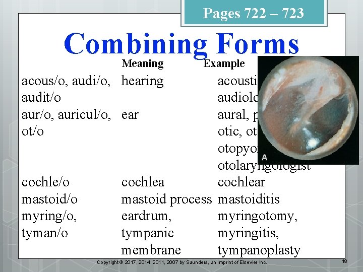 Pages 722 – 723 Combining Forms Meaning Example acous/o, audi/o, hearing audit/o aur/o, auricul/o,