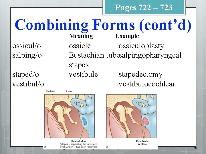 Pages 722 – 723 Combining Forms (cont’d) Meaning ossicul/o salping/o staped/o vestibul/o Example ossiculoplasty