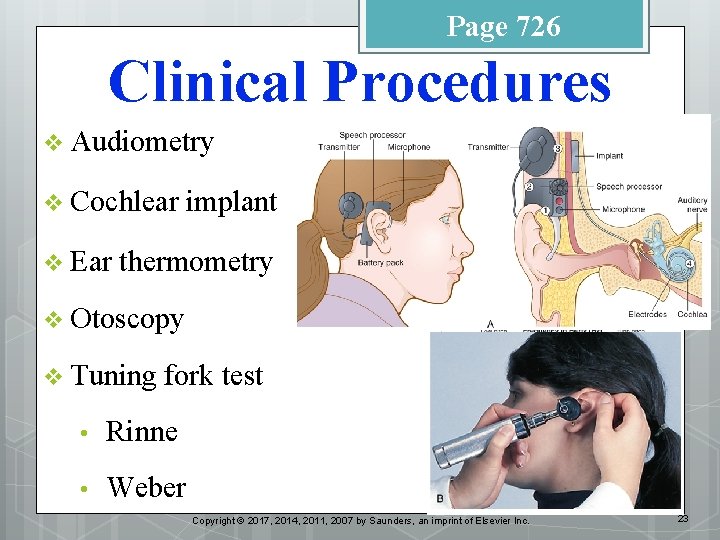 Page 726 Clinical Procedures v Audiometry v Cochlear v Ear implant thermometry v Otoscopy