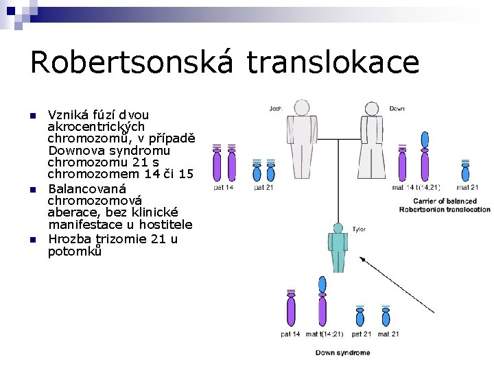 Robertsonská translokace n n n Vzniká fúzí dvou akrocentrických chromozomů, v případě Downova syndromu